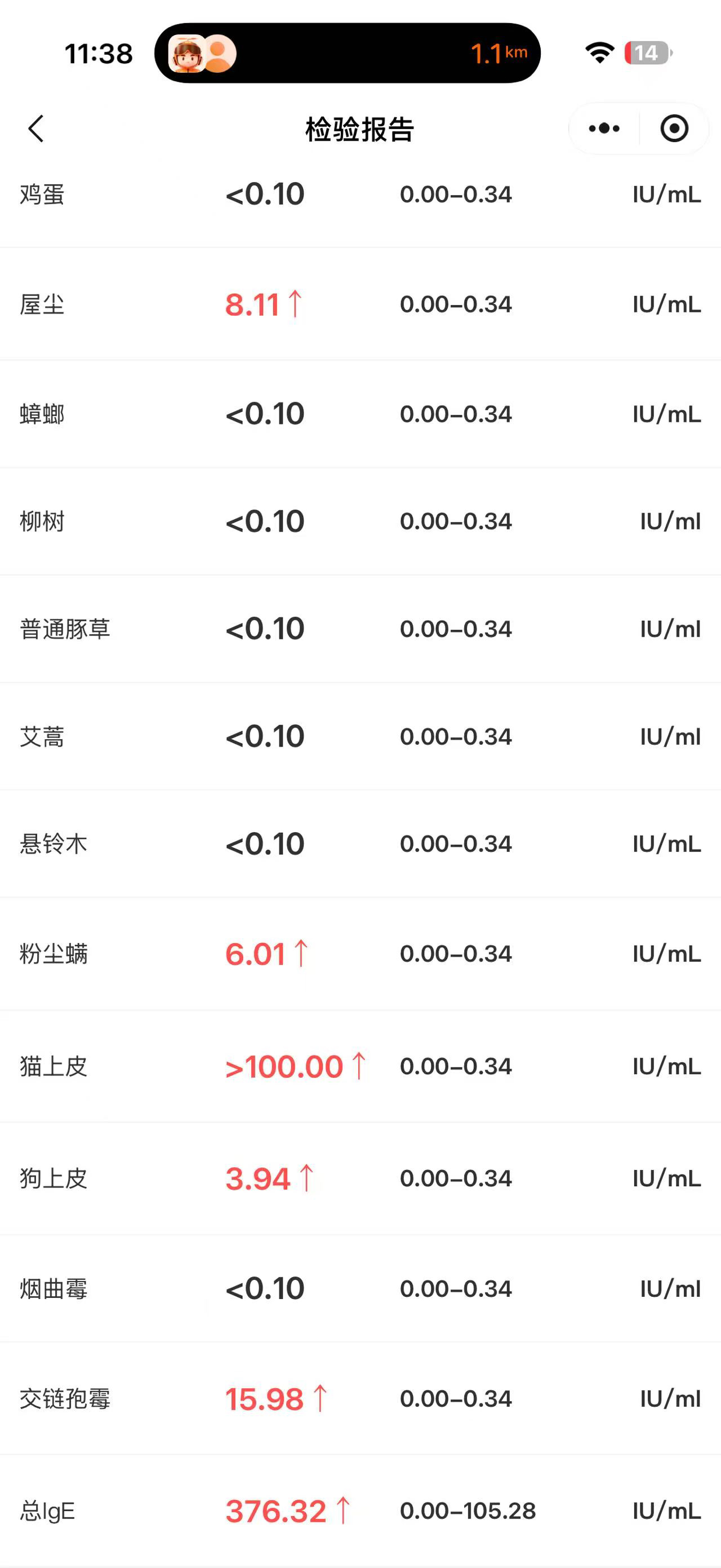 接小朋友回来了
要重新找家了
小孩哥过敏🤧
半夜喘不上气
现在还在医院吸氧